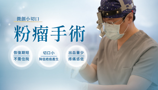 Read more about the article 粉瘤